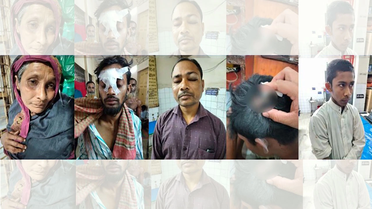 জমি সংক্রান্ত বিরোধের জেরে সংঘর্ষে নারীসহ পাঁচজন আহত । ছবি : গ্রামের কাগজ