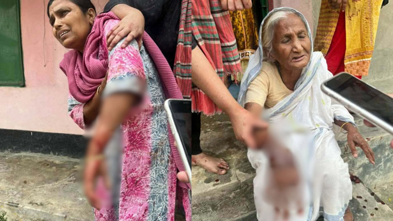 মিরসরাইয়ে সিসিটিভি বসানো নিয়ে মারামারি, বৃদ্ধাসহ আহত ৬