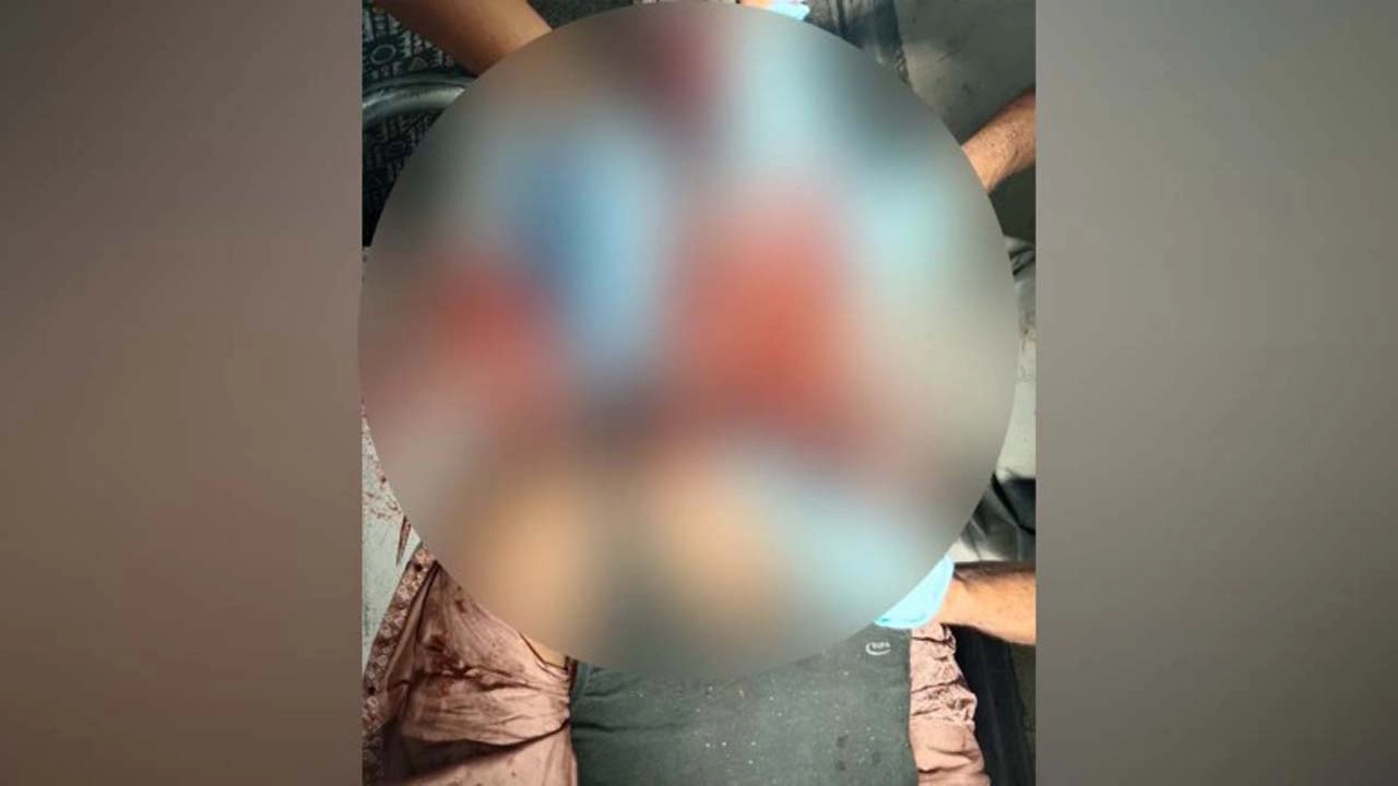 বাঘারপাড়ায় দুই মোটরসাইকেলের মুখোমুখি সংঘর্ষে মামুন নামে এক যুবক গুরুতর আহত। ছবি: গ্রামের কাগজ