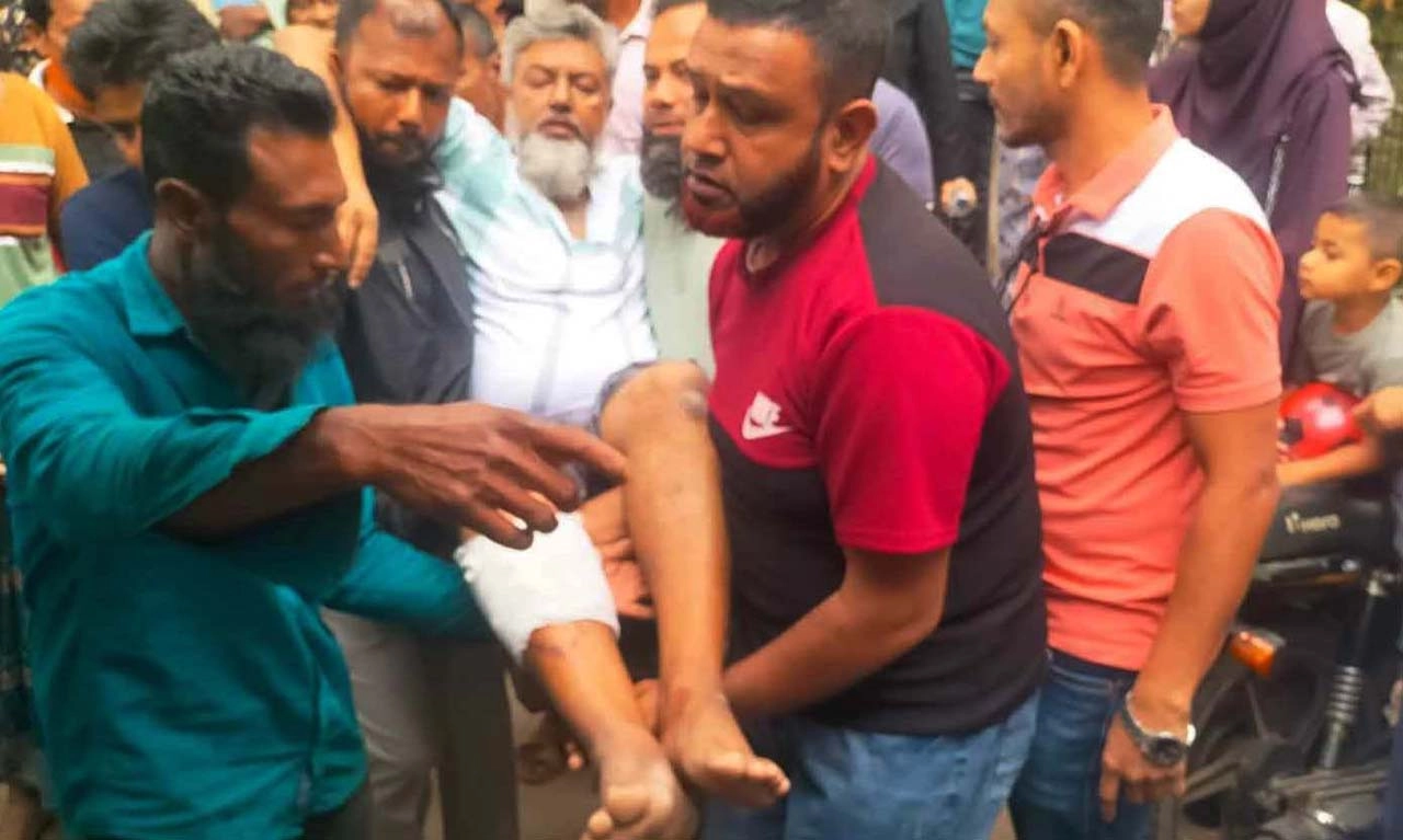 যশোরের অভয়নগরে মারপিটের পর আহত আওয়ামী লীগ নেতা আব্দুর রউফ মোল্যাকে হাসপাতালে নেওয়া হয়।ছবি: গ্রামের কাগজ