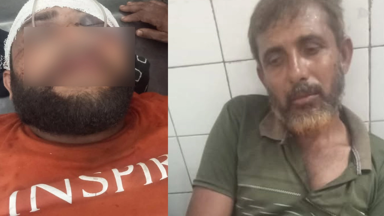 পূর্ব শত্রুতার জেরে ঝিকরগাছায় হামলা : পিতা-পুত্র আহত