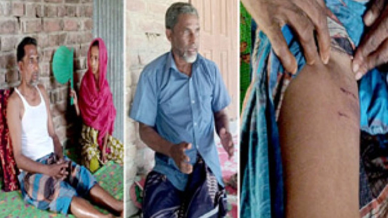 কুকুরের কামড়ে আহতরা । ছবি : প্রতিনিধি