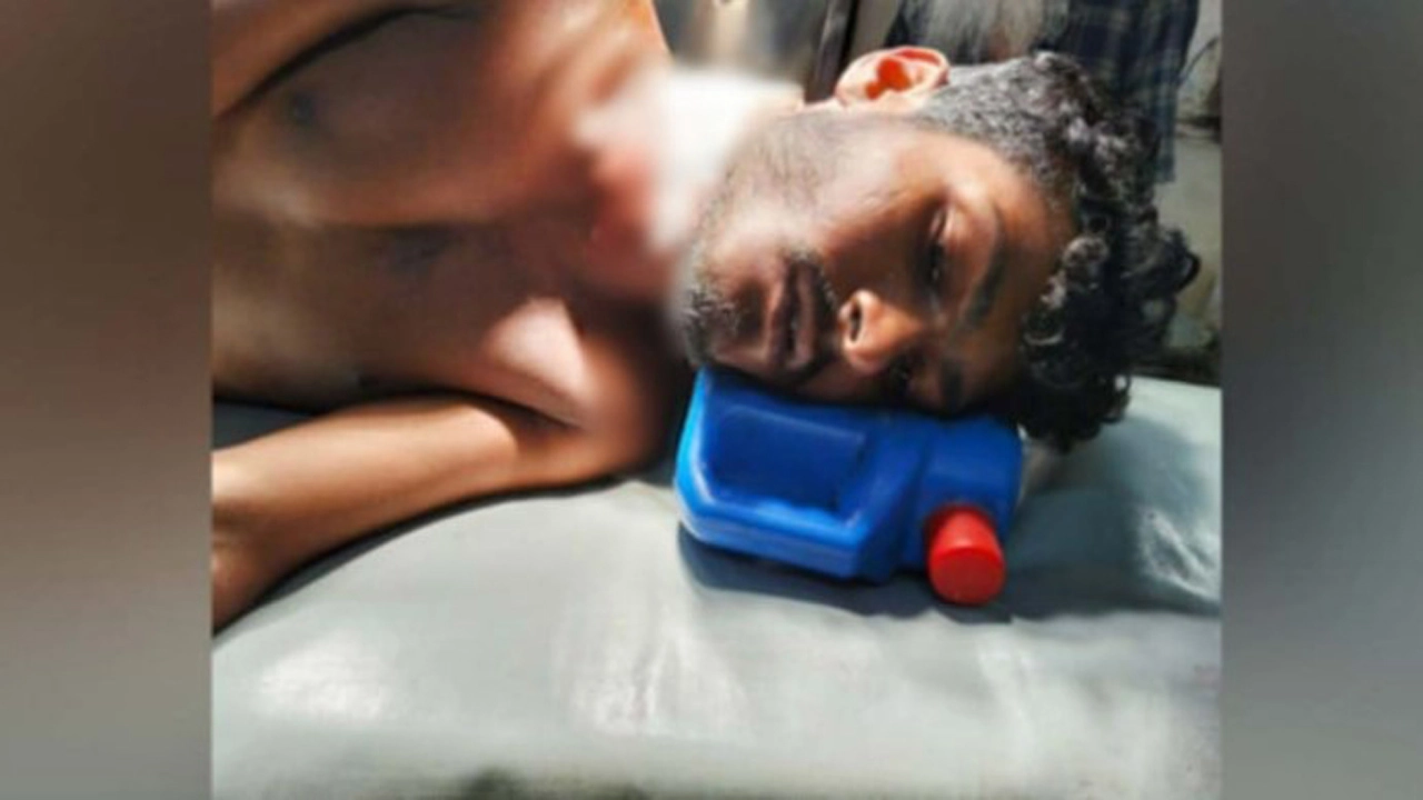 পারিবারিক বিরোধের জেরে বড় ভাইয়ের আঘাতে ছোট ভাই আহত। ছবি: সংগৃহীত