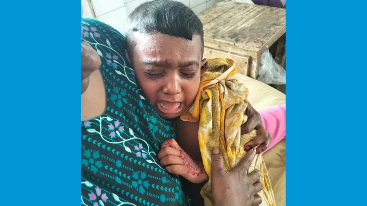 যশোরে বোমা সদৃশ বস্তু বিস্ফোরণে আহত ২ শিশু