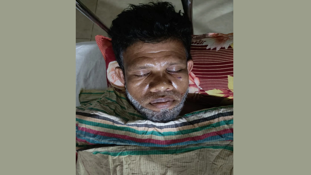গ্রামে প্রতিপক্ষের হামলায় আহত কামরুল ইসলাম । ছবি : গ্রামের কাগজ