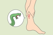 shornollata